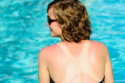 5 downsides of tanning you didnt know about 600x350 picmobhome