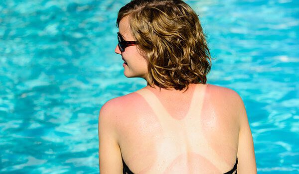 5 downsides of tanning you didnt know about 600x350 picmobhome